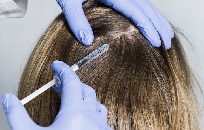 мезотерапия для волос